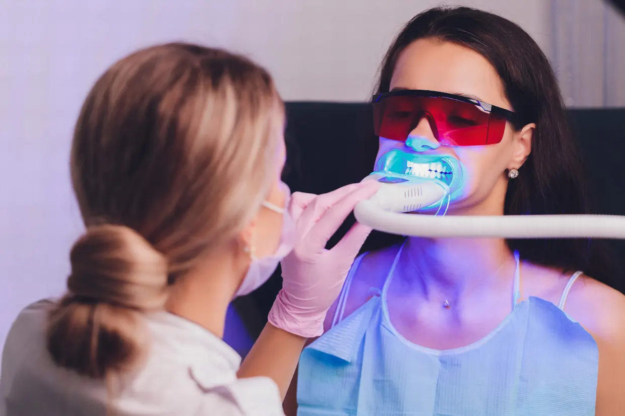 Відбілювання зубів лампою в клініці HAPPYDENT
