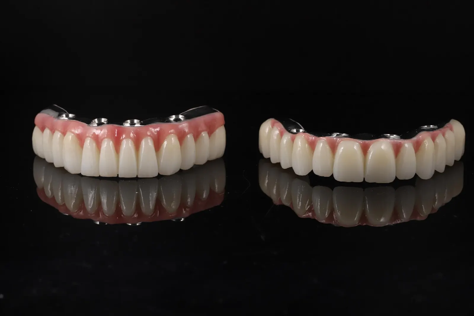 Komplexná rekonštrukcia chrupu, zavedenie zubných implantátov all-on-4 v Košiciach a Chorvátskom Grobe pri Bratislave