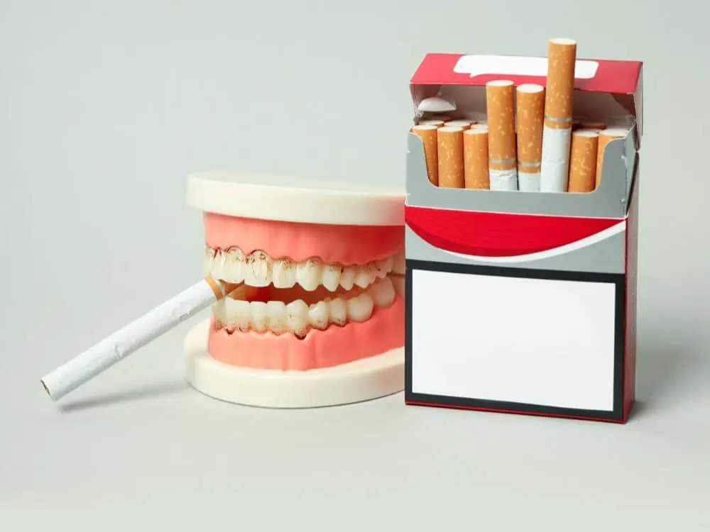 Fajčenie a zafarbenie zubov – model chrupu vedľa krabičky cigariet