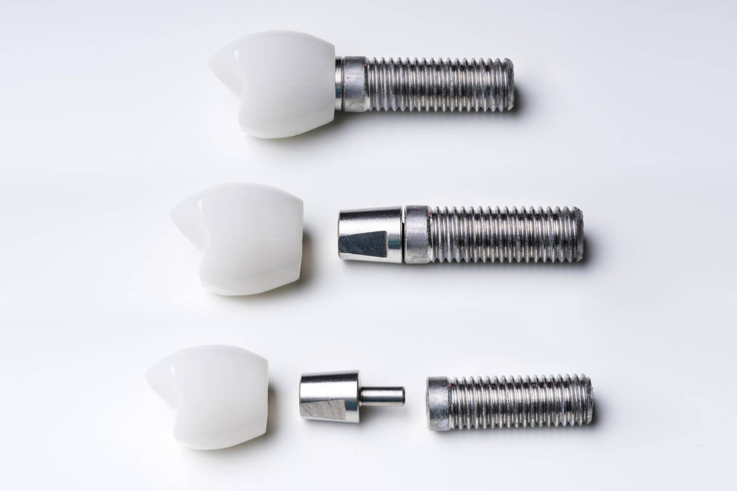 Miniimplantát – čo to je a na čo slúži?