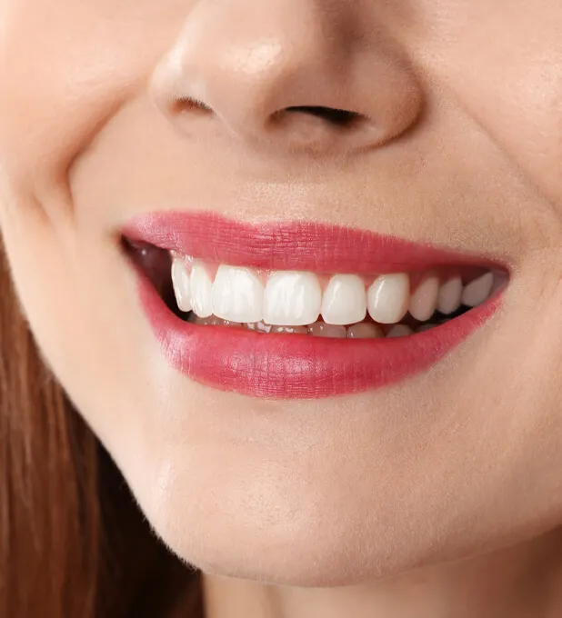 Zuby po bielení v zubnej ambulancii HAPPYDENT v Košiciach a Chorvátskom Grobe