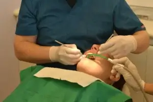 Riziká zubnej turistiky: Zistite, prečo sa lacné implantáty z Turecka či Srbska môžu predražiť a aké zdravotné komplikácie vám hrozia bez následnej starostlivosti