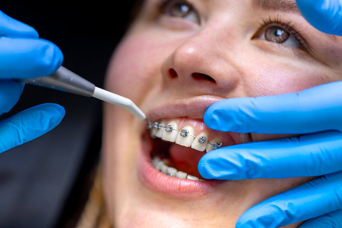 dentálna hygiena pri zuboch so strojčekom